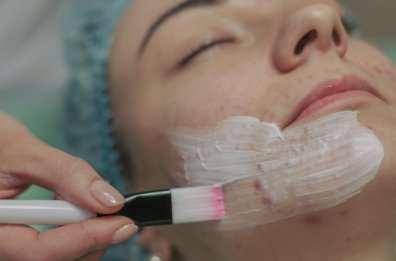 Traitement de l'acné