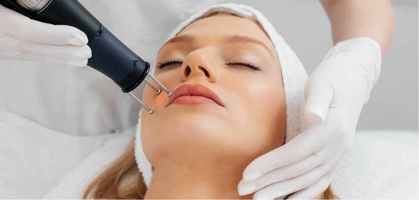 resurfaçage cutané au laser 1