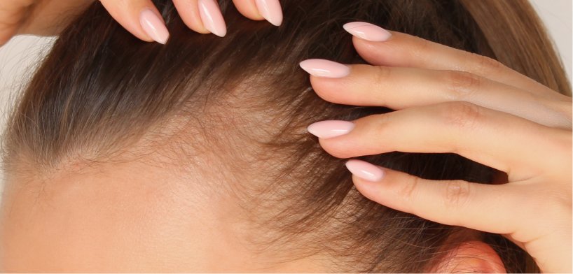postpartum hair loss treatment new