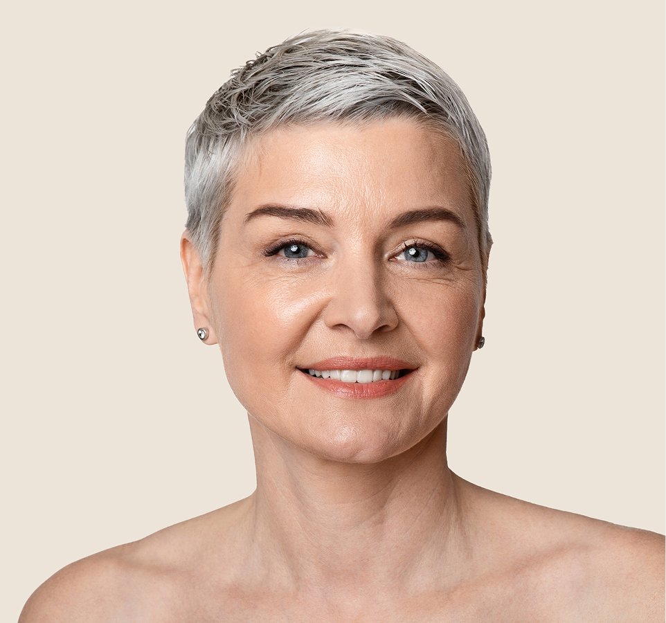 nasolabial folds what to expect