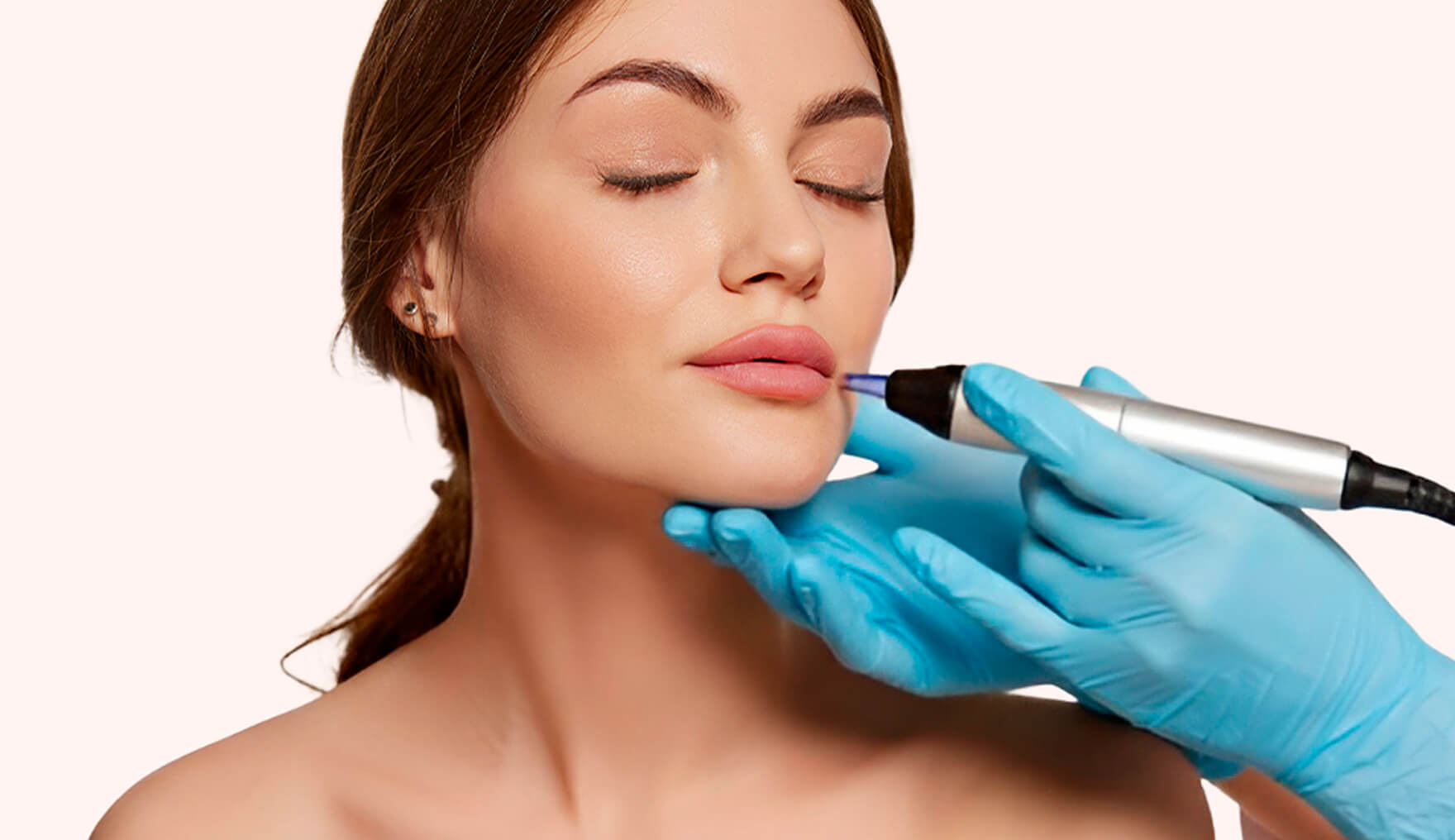 microneedling Laval m