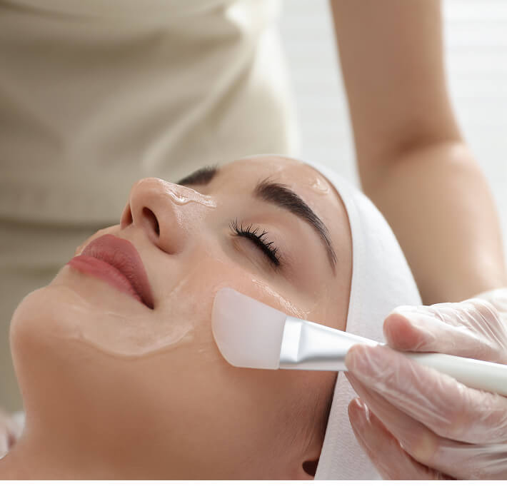 traitement de peeling chimique du visage Laval