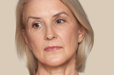 Ridules et changements de texture