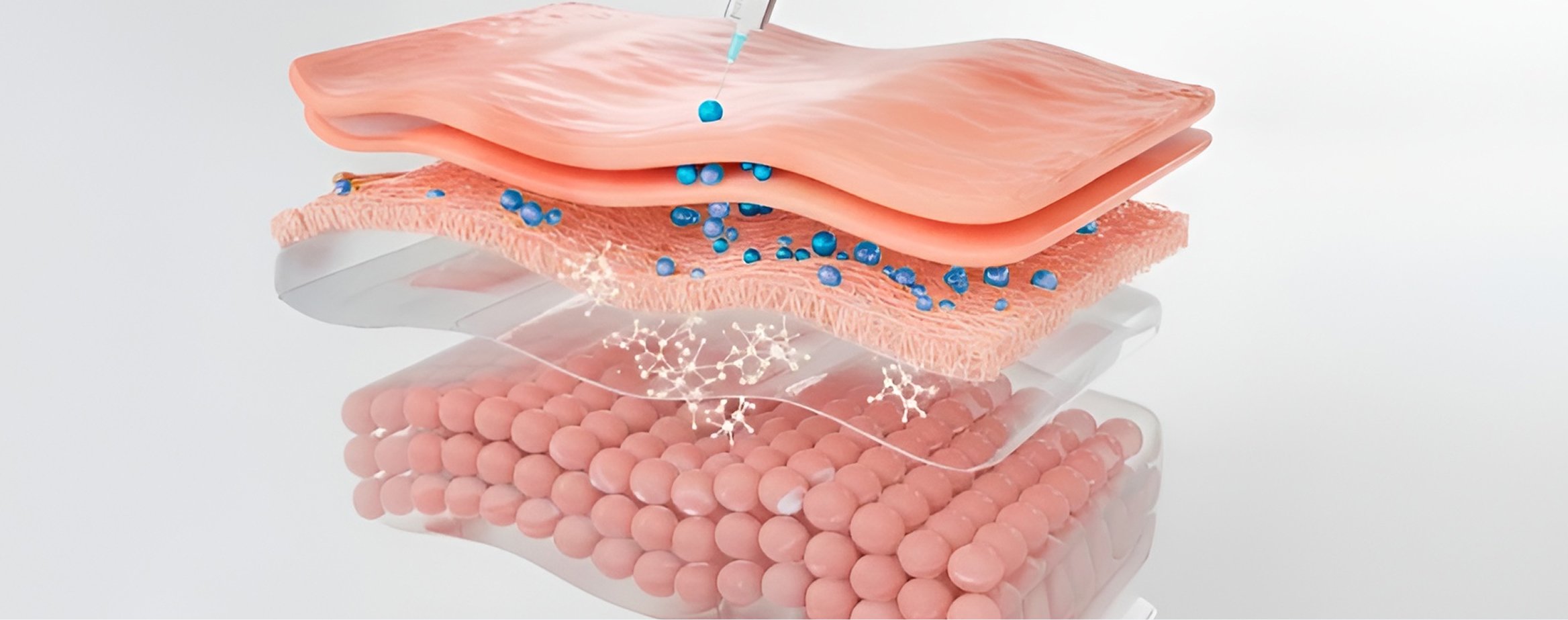 comment fonctionne votre traitement aux neuromodulateurs