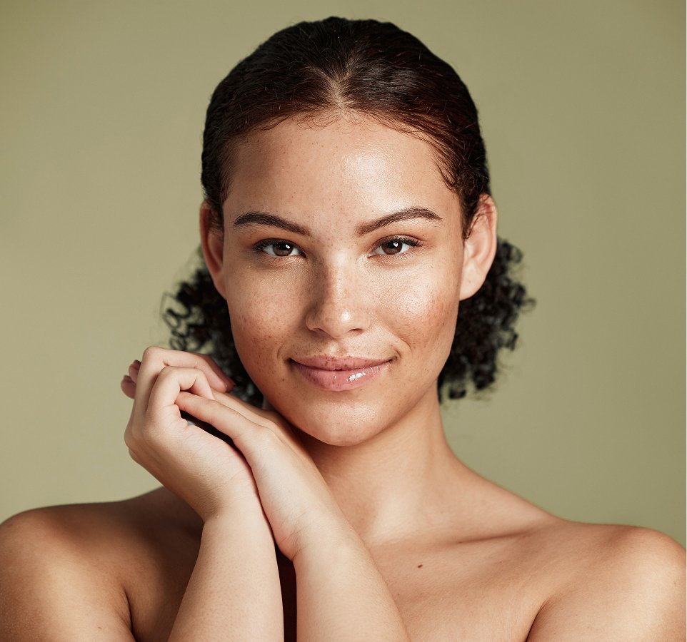 hyperpigmentation what to expect