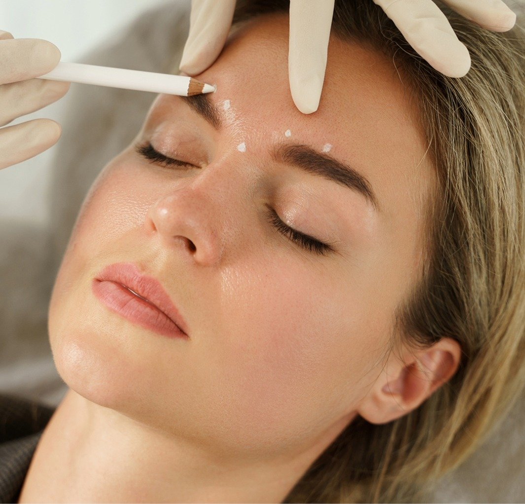 traitement neuromodulateur laval