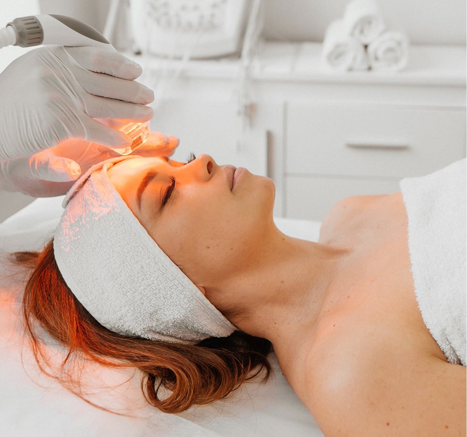 redness rosacea treatment options