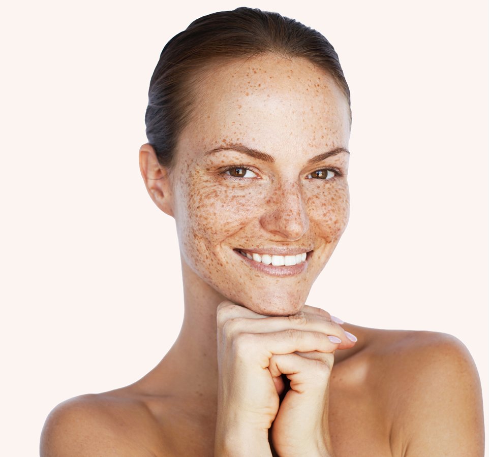 hyperpigmentation causes