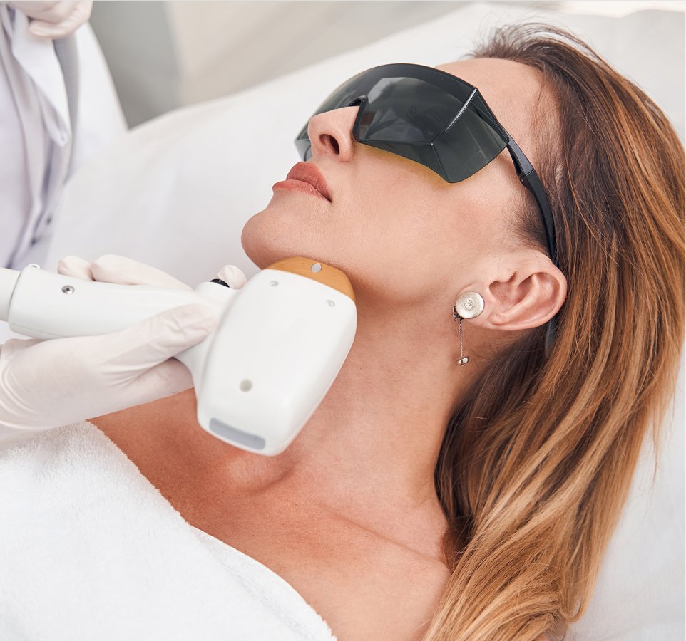 hyperpigmentation treatment options