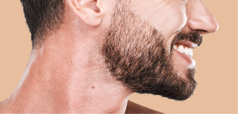 Beard Density Treatment