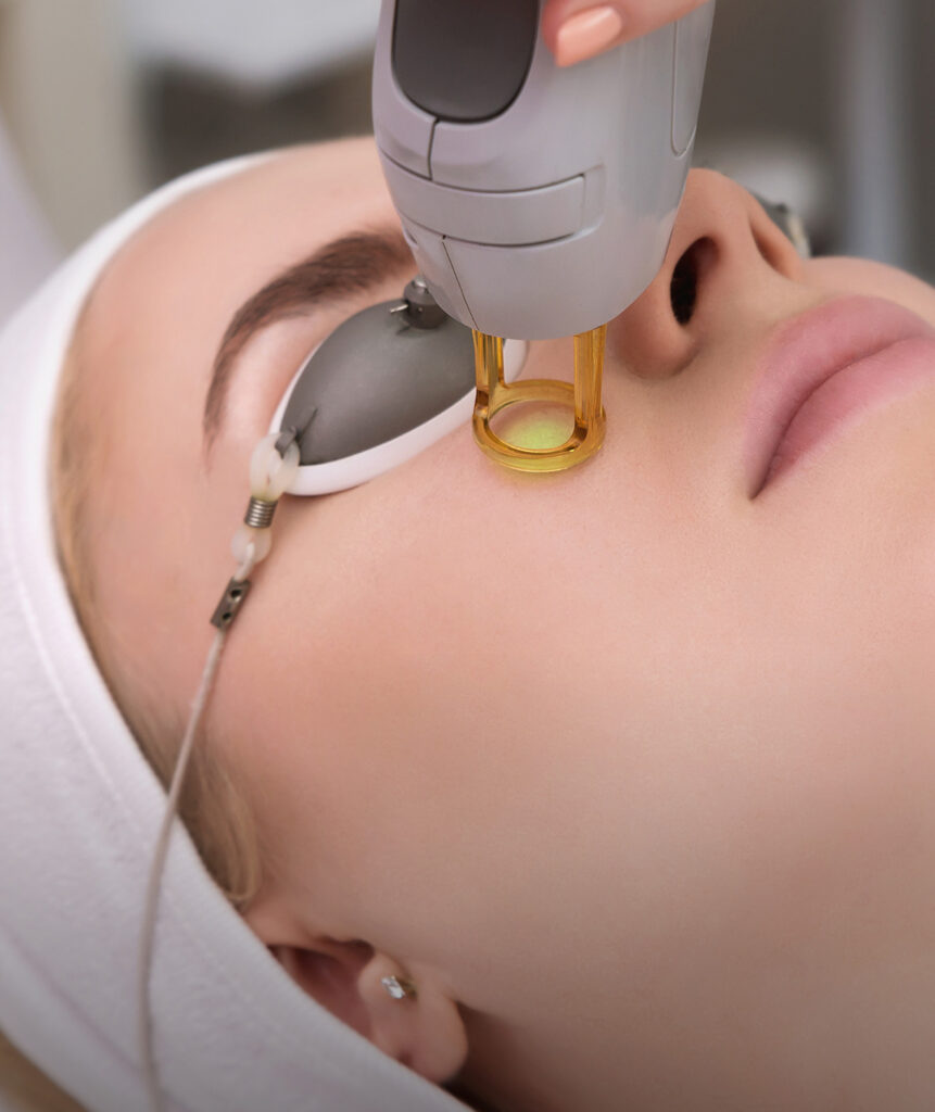 1570 nm Collagen Laser default
