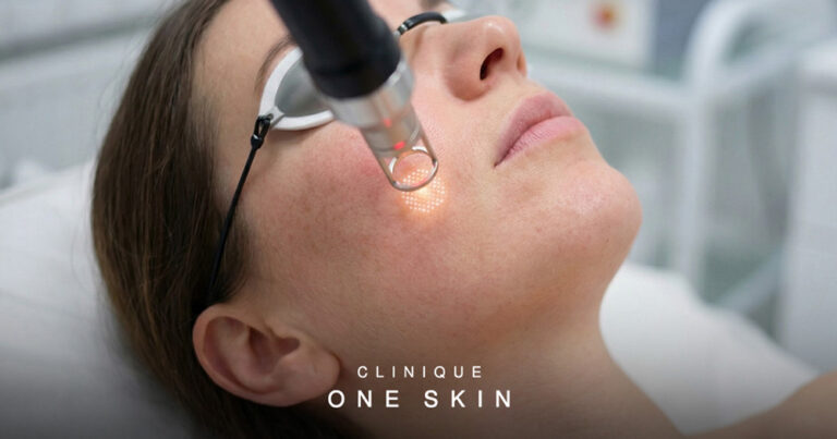 Benefits Of Long Term Skin Planning