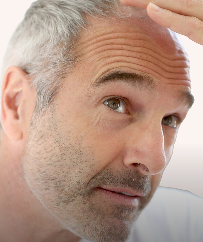 Hair Restoration default