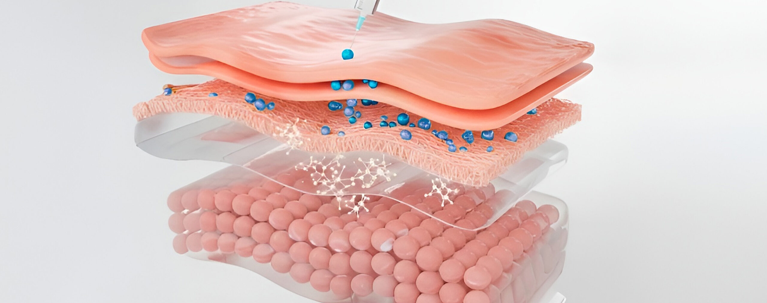how sculptra works
