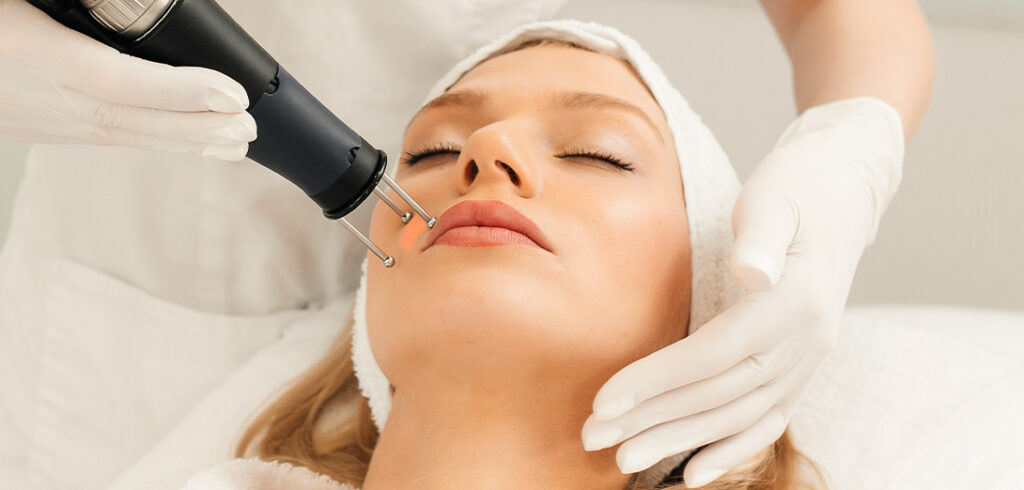 laser skin resurfacing