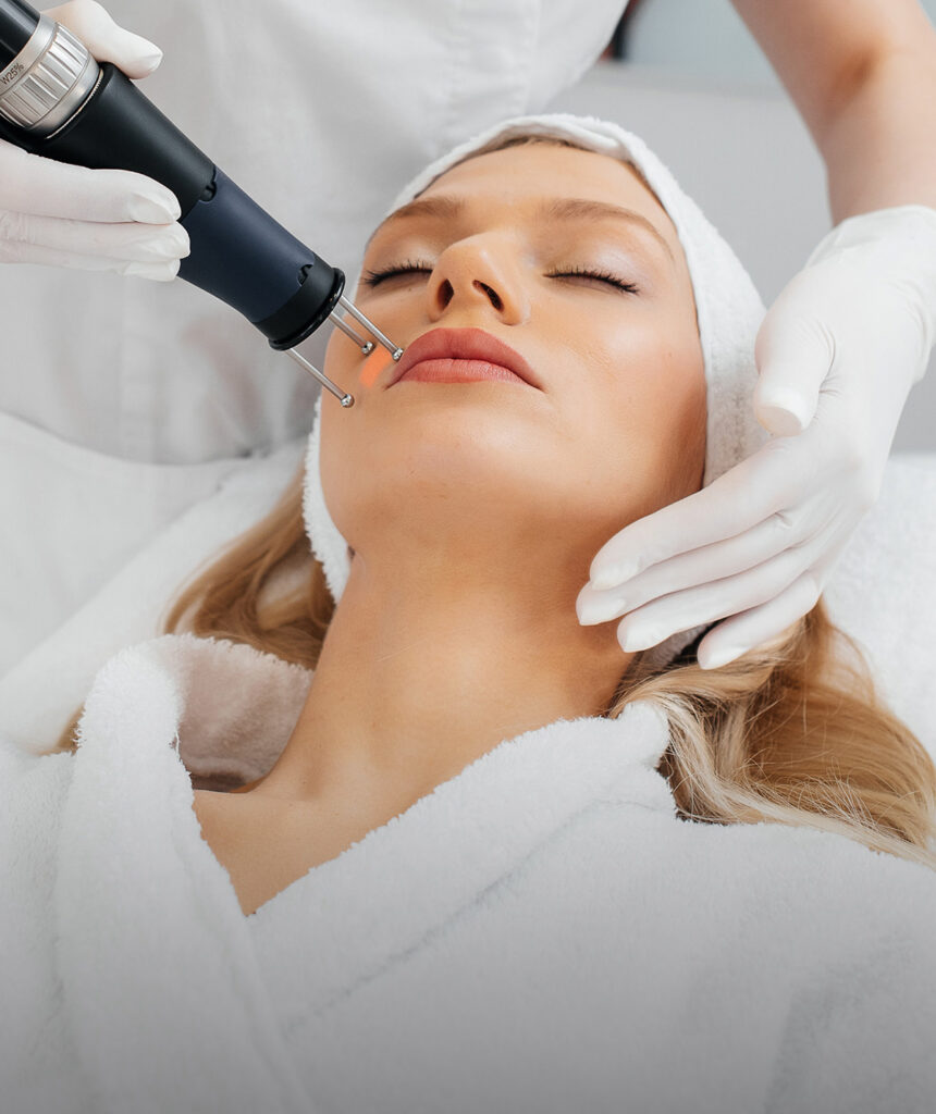 Laser Treatment for Acne Scarring default