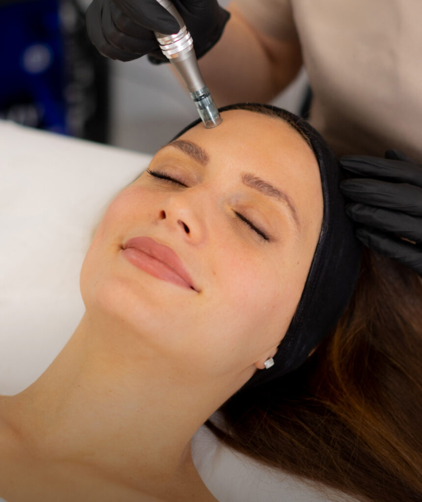 Medical Grade Microneedling default