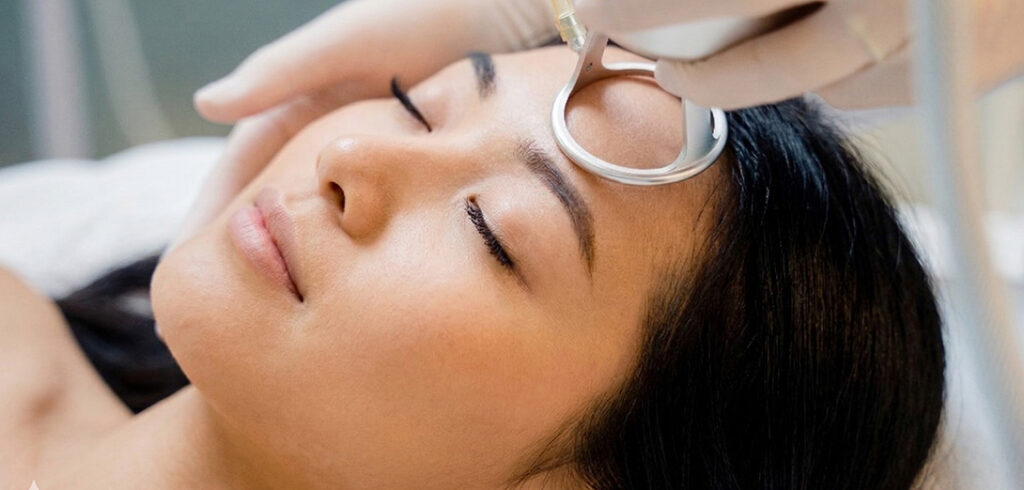 skin tightening