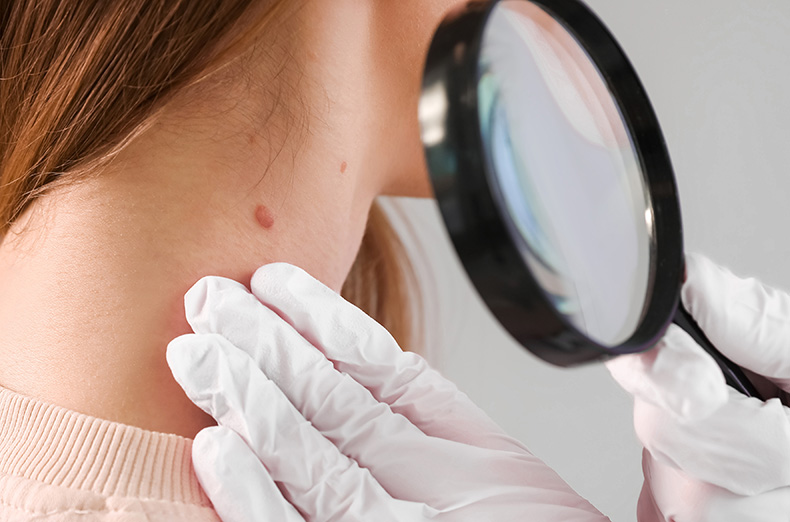 suspicious lesion evaluation