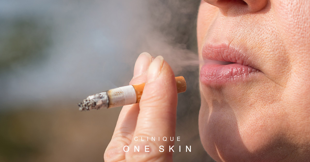 What Causes Smoker Lines and How They’re Treated Medically