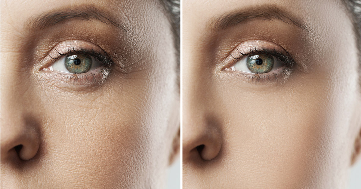 Reverse Wrinkles and Slow Down Aging