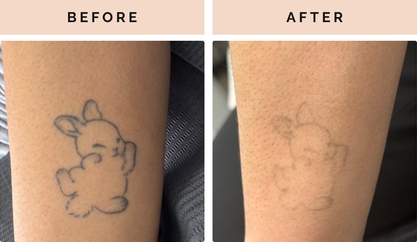 B&A Slide 1