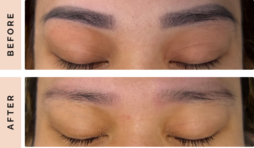 B&A Slide 2