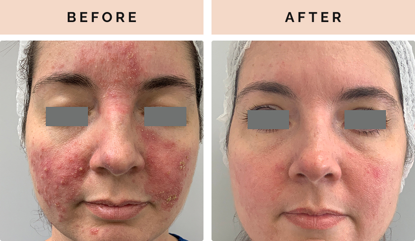 before after 4