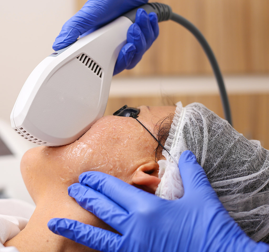 Pre-Treatment Pigment Suppression Phase