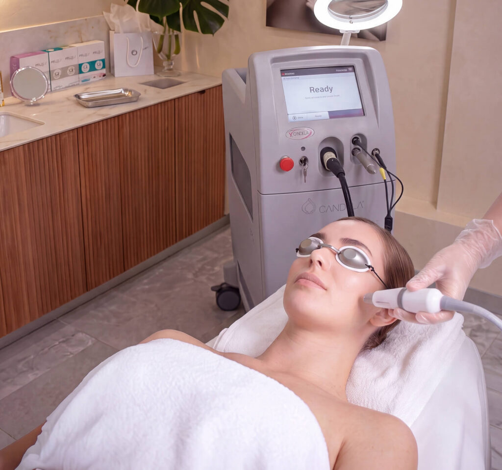 rosacea facial