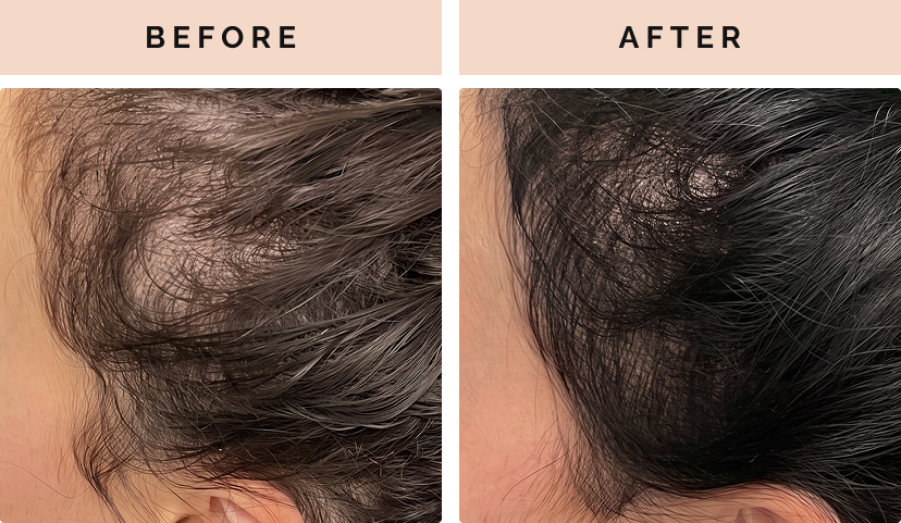 before after 1