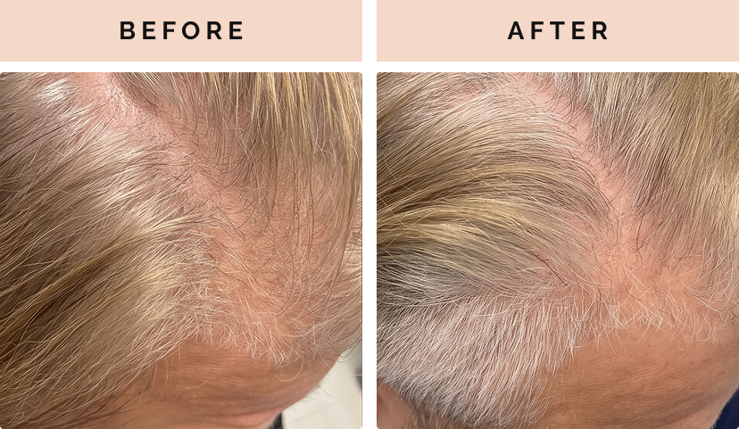 before after 2