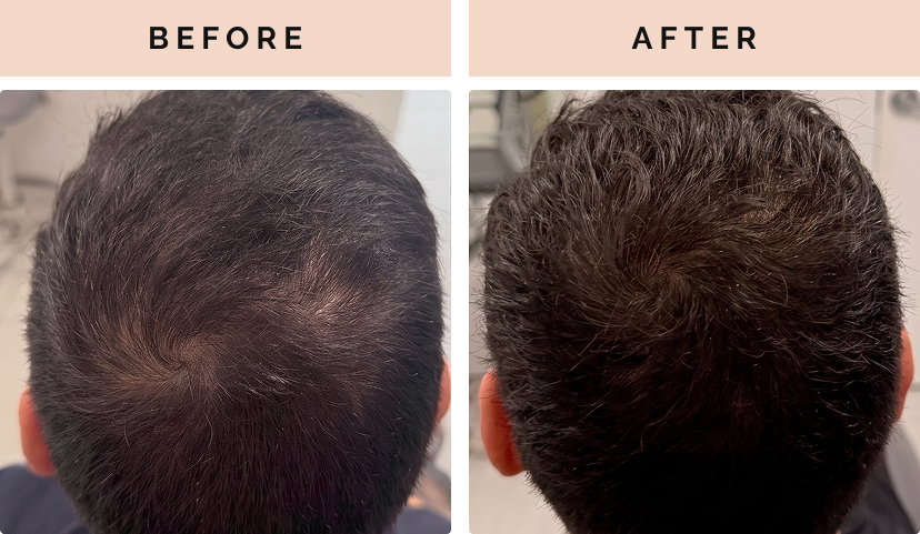 before after 3