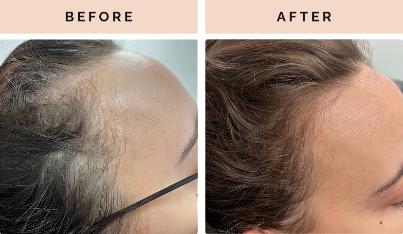 before after 4
