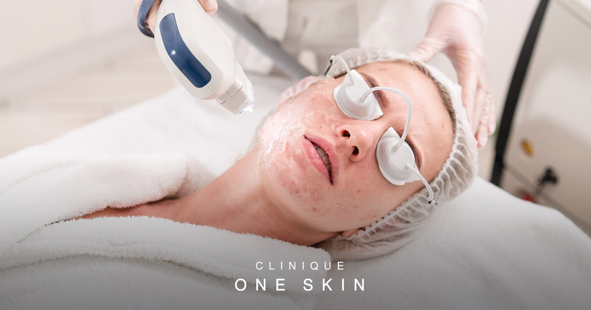 Is Dermatology Covered by Insurance for Acne and Skin Treatment